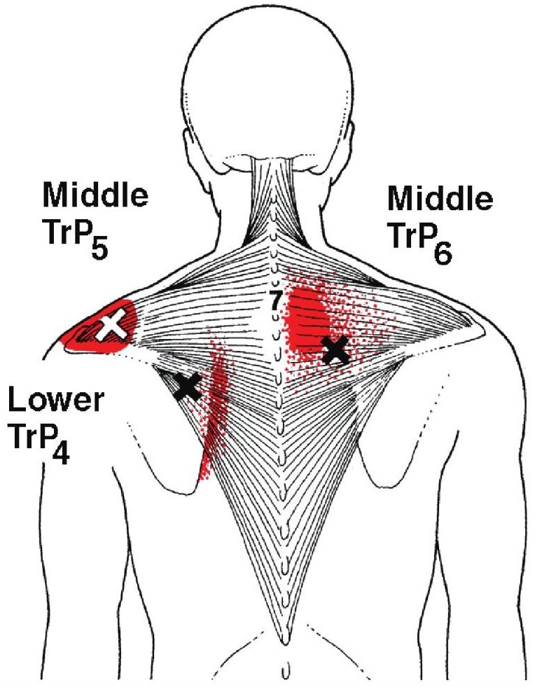 Medical Massage